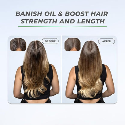 XMONDO Hair BOOST X Dry Shampoo, Zero Residue, Formulated with Saw Palmetto to Promote Scalp Care, Clinically Tested, Dermatologist Tested, Talc-free, Benzene-free, Free of aluminum starch, 5 oz