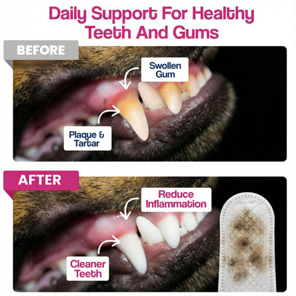 Dental Finger Wipes for Teeth Cleaning (50 Count)